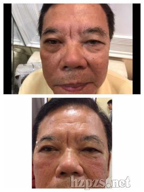 ���_(k��i)�����۴�