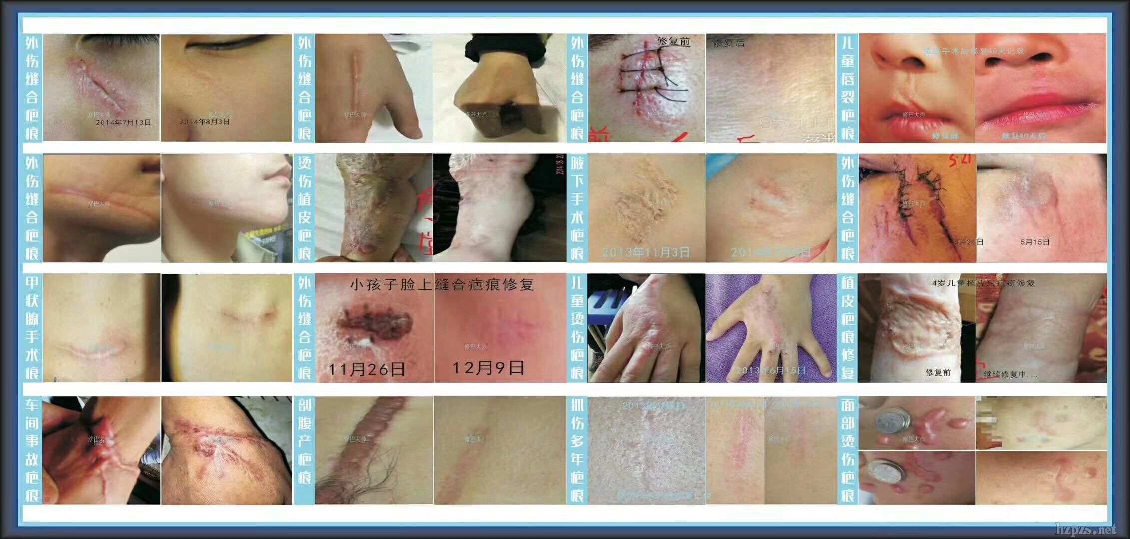 ȥ��-�ް̮a(ch��n)Ʒ-Ч�������M�w��ްʹ�